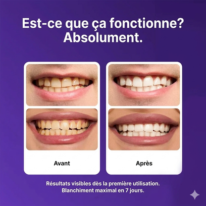 Bandes Blanchissantes correctrices de couleur - Résultats rapides, Sensibilité nulle